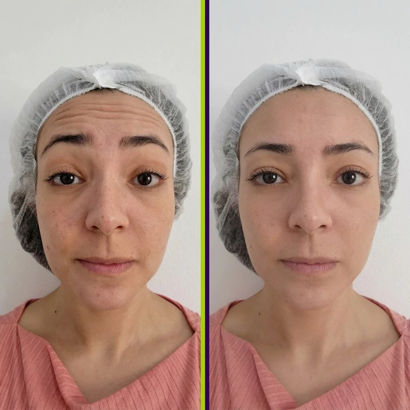 Aplicação Estética Avançada