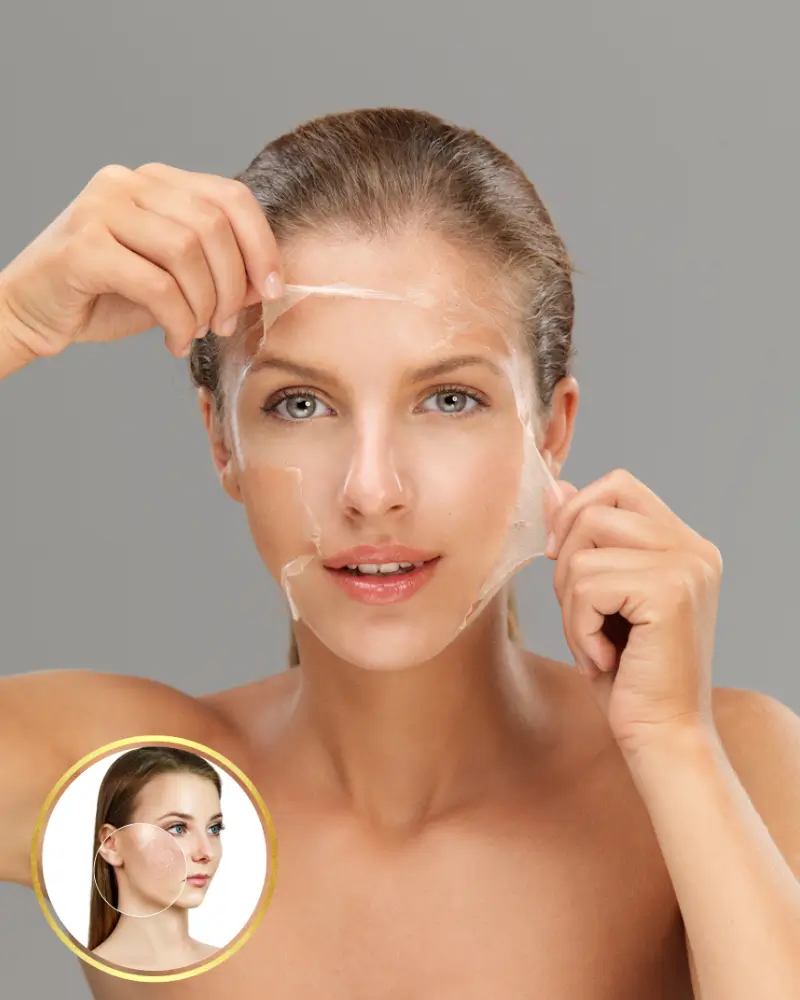 Peeling facial para clareamento de manchas e renovação da pele na Clínica Estética Vital Beauty em Mogi das Cruzes