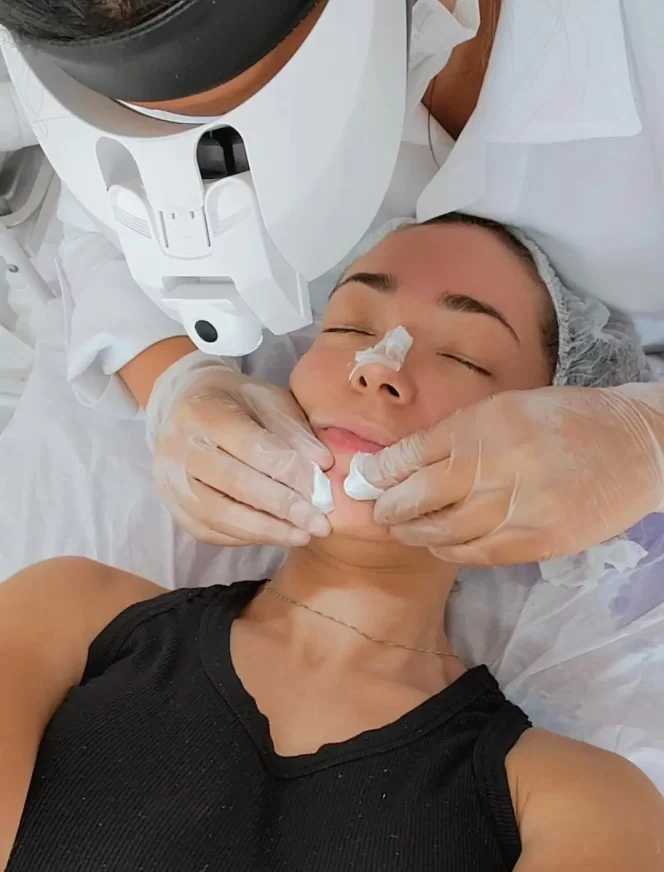 Limpeza de pele profunda em Mogi das Cruzes com extração e hidratação