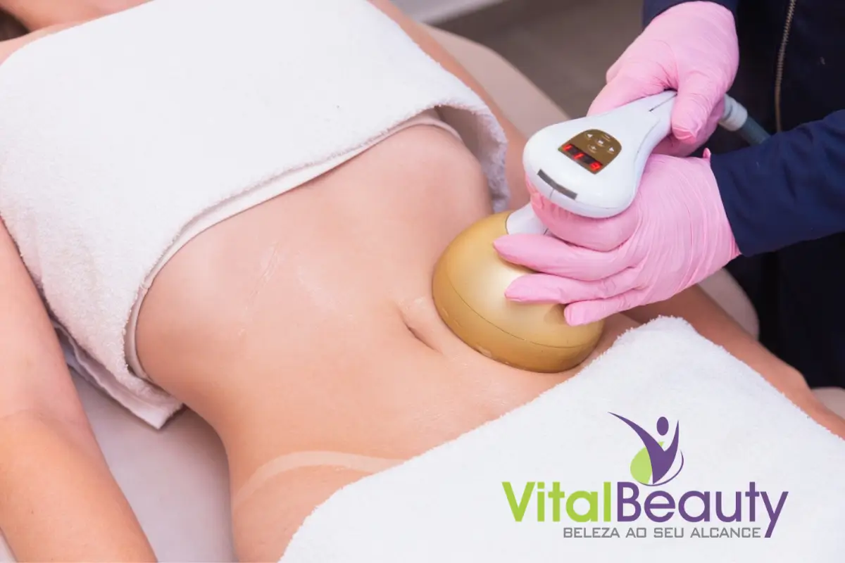 Tratamento estético contra gordura localizada realizado na clínica Vital Beauty em Mogi das Cruzes